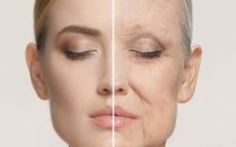 9 روش درمان چروک پوست با داروی گیاهی در خانه