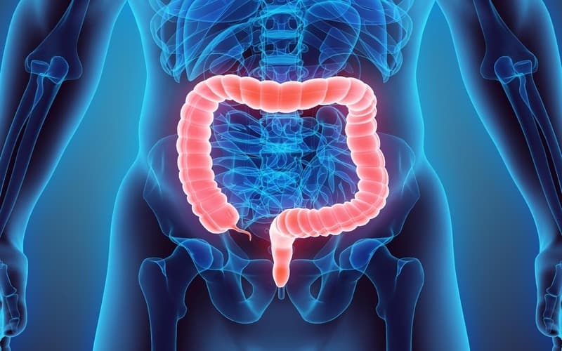 کولیت روده چیست؟ |8 راه درمان کولیت اولسراتیو