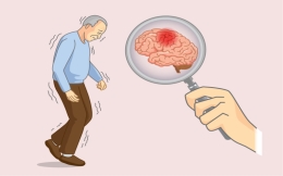 10  علائم آلزایمر که باید بدانید! | معرفی بهترین راه پیشگیری از آلزایمر